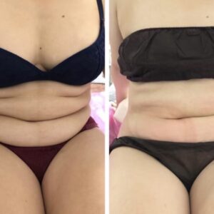 {{ $property->title }}のサムネイル