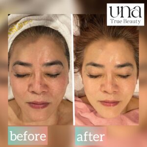 {{ $property->title }}のサムネイル