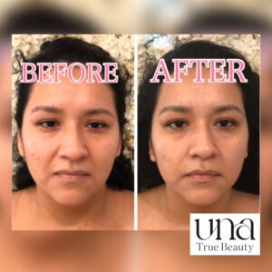 {{ $property->title }}のサムネイル