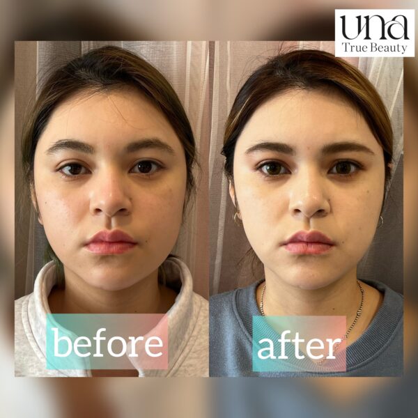 {{ $property->title }}の写真