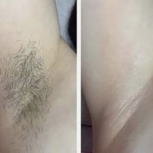 {{ $property->title }}のサムネイル