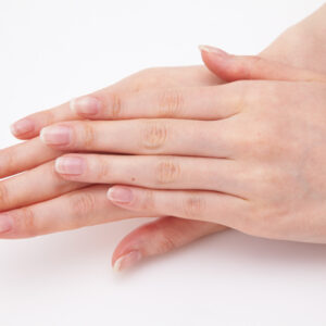 {{ $property->title }}のサムネイル