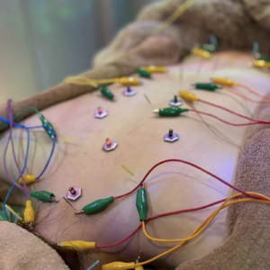 {{ $property->title }}のサムネイル