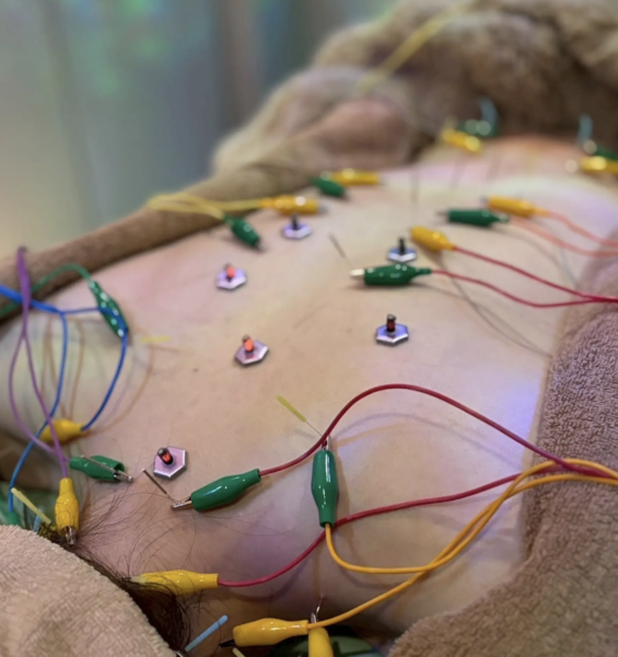 {{ $property->title }}の写真